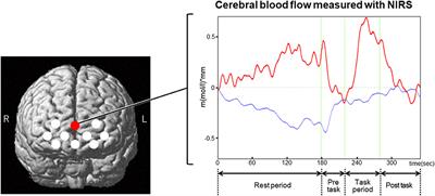 Application of Near-Infrared Spectroscopy for Understanding Spontaneous Brain Activity During Resting State in Schizophrenia: A Mini Review